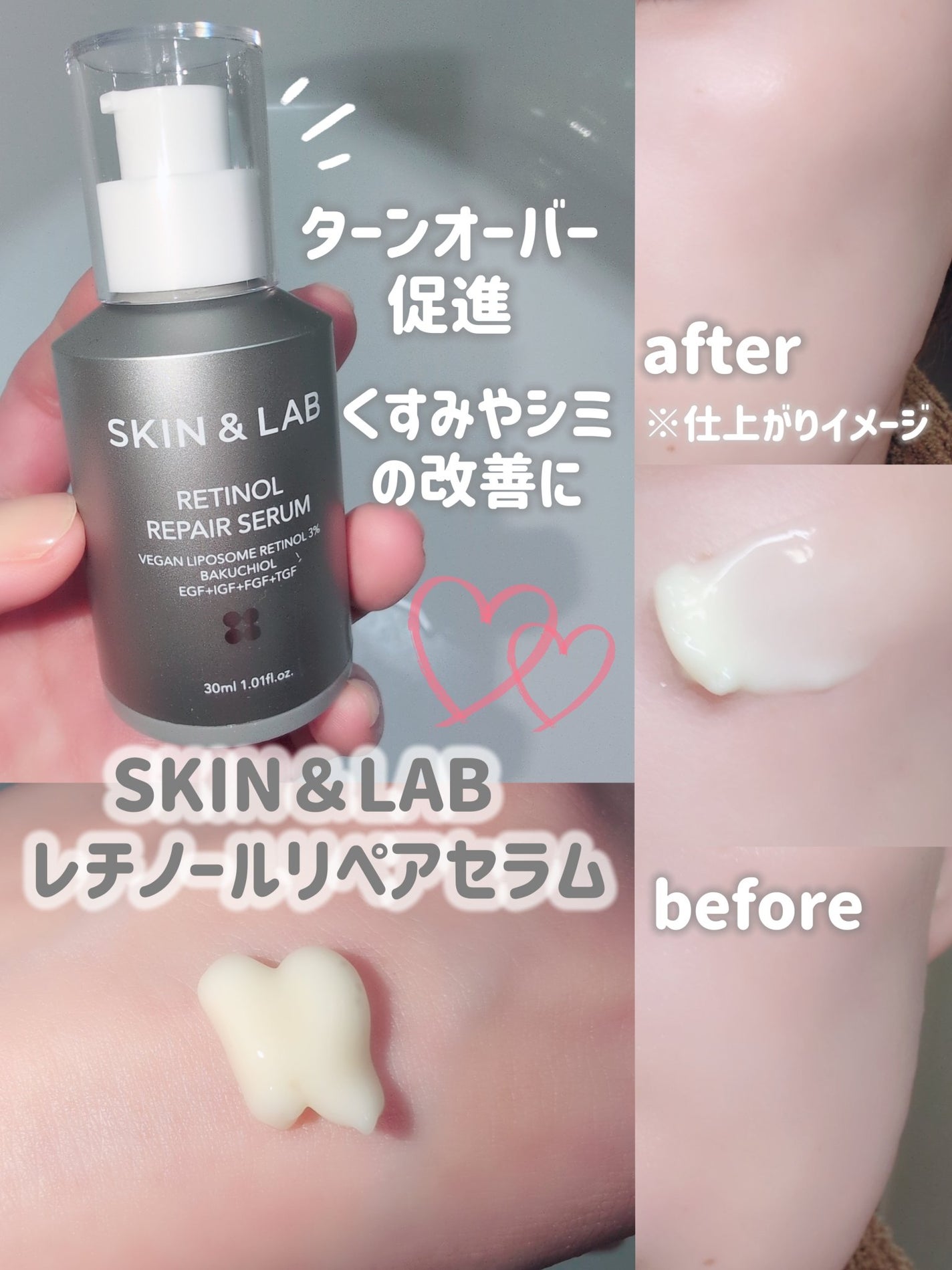 バリアダームモイストクリーム/SKIN&LAB/フェイスクリームを使ったクチコミ(4枚目)
