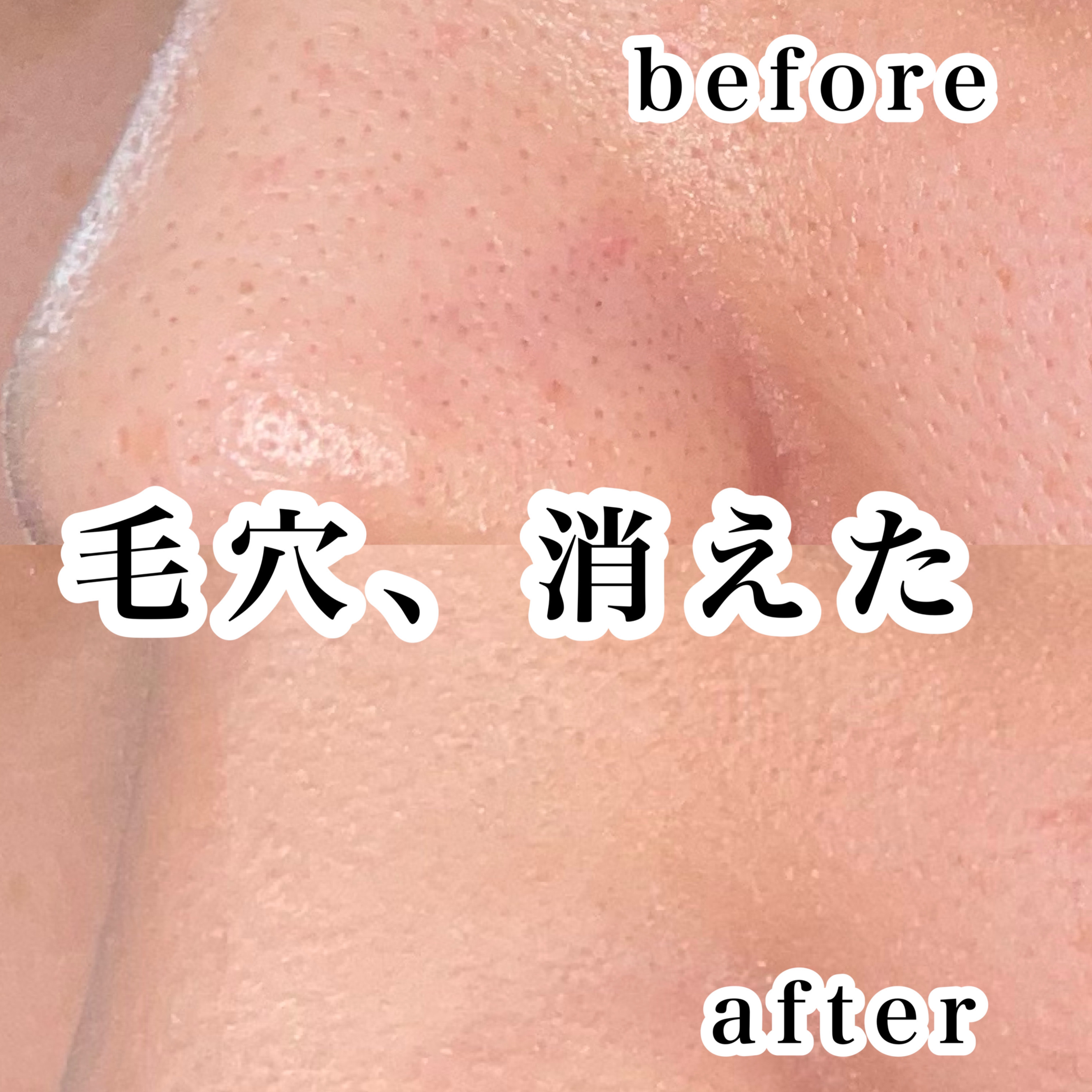 ノーモアブラックヘッド(ノーズピーリング)/One-day's you/スクラブ・ゴマージュを使ったクチコミ（1枚目）