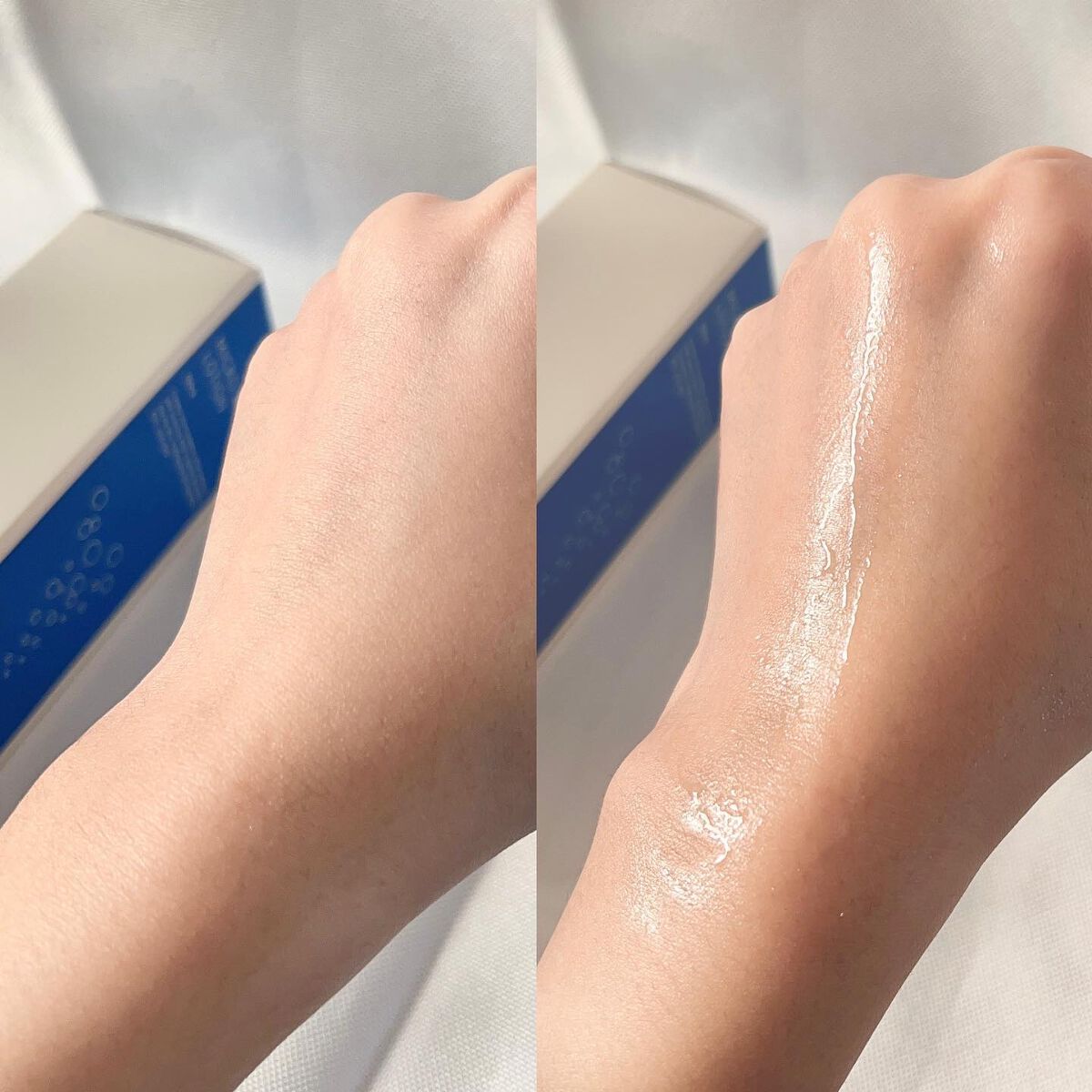 薬用マイクロバブルローション/Macchia Label/化粧水を使ったクチコミ(4枚目)