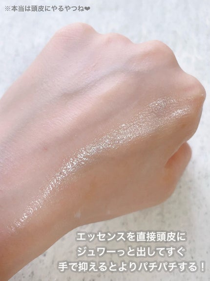 ごんす@YouTube始めました on LIPS 「《夏にオススメパチパチ弾ける頭皮美容液❤︎》ひんやり冷たくパチ..」(5枚目)