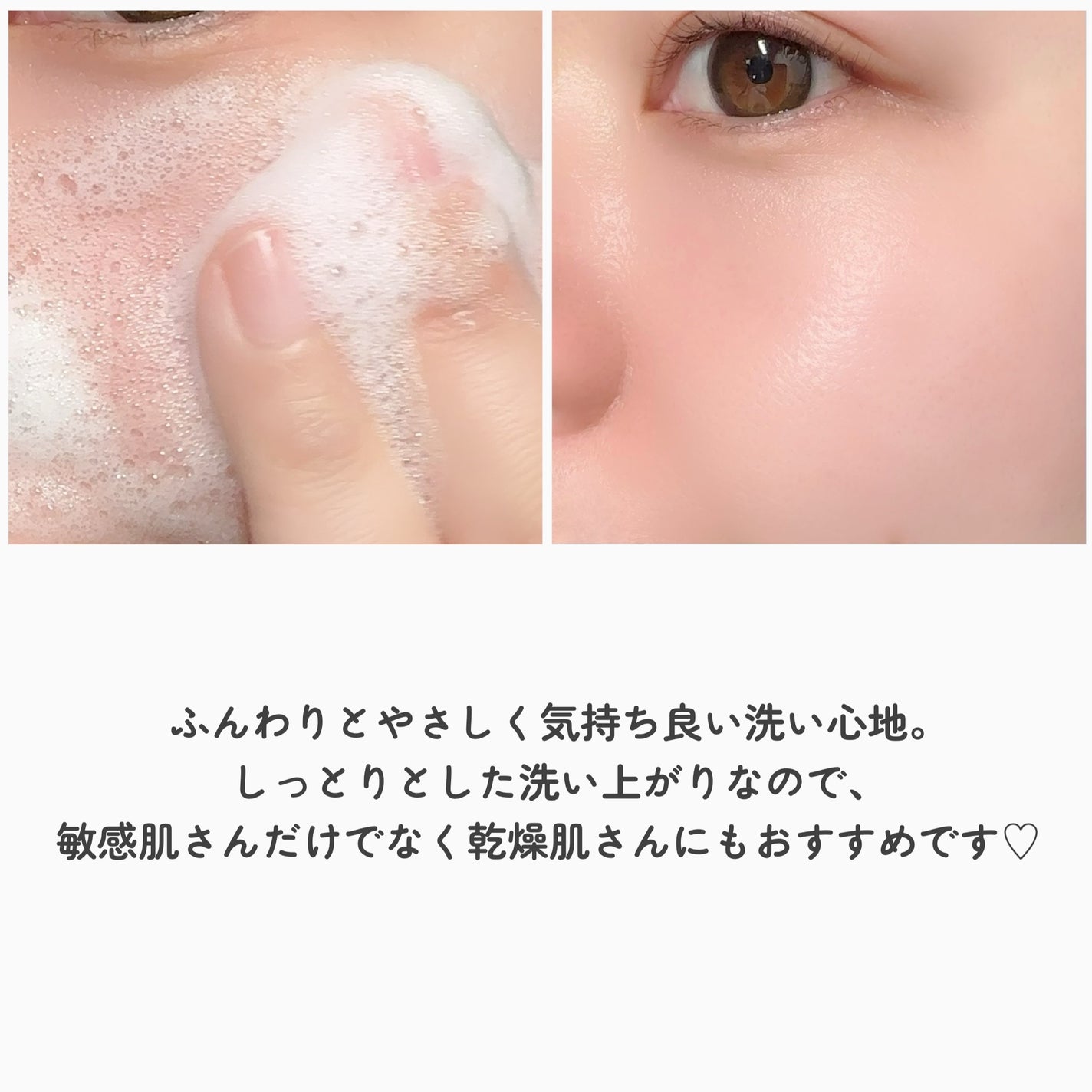 フェイシャルウォッシュフォーム(しっとり)/セバメド/洗顔フォームを使ったクチコミ(5枚目)