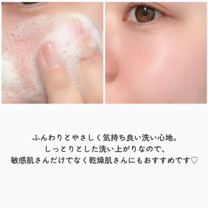 フェイシャルウォッシュフォーム(しっとり)/セバメド/洗顔フォームを使ったクチコミ(5枚目)