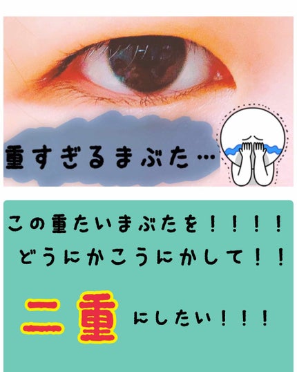 メザイク ストリングファイバー120 ディープタイプのクチコミ「⚠️2枚目以降、目の画像がついております!
まぶたが重すぎて、二重なんて諦め…きれない!!!.....」(2枚目)