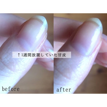 ORLY キューティークのクチコミ「わたしの甘皮処理

つかうもの
・ORLY キューティーク
・ORLY メタルプッシャー

①.....」（2枚目）