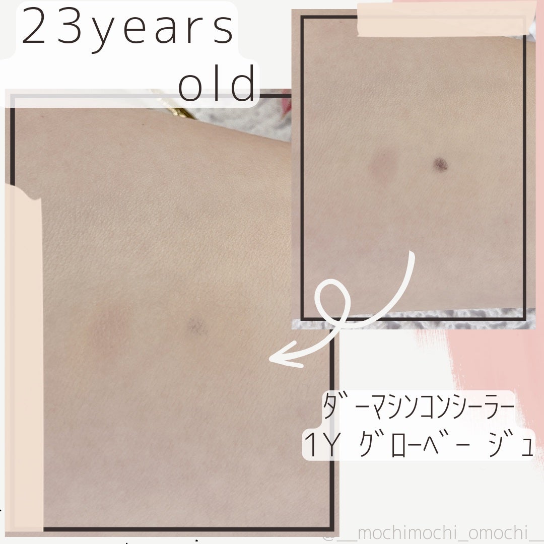 ダーマシンコンシーラー/23years old/リキッドコンシーラーを使ったクチコミ(2枚目)