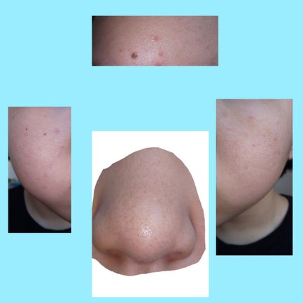 ロゼット 洗顔パスタ 荒性肌/ロゼット/洗顔フォームを使ったクチコミ(3枚目)