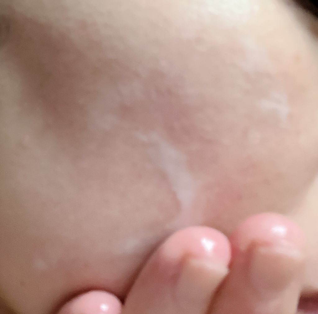 ベビー・アトクリーム/モンディエス/ボディクリームを使ったクチコミ（3枚目）