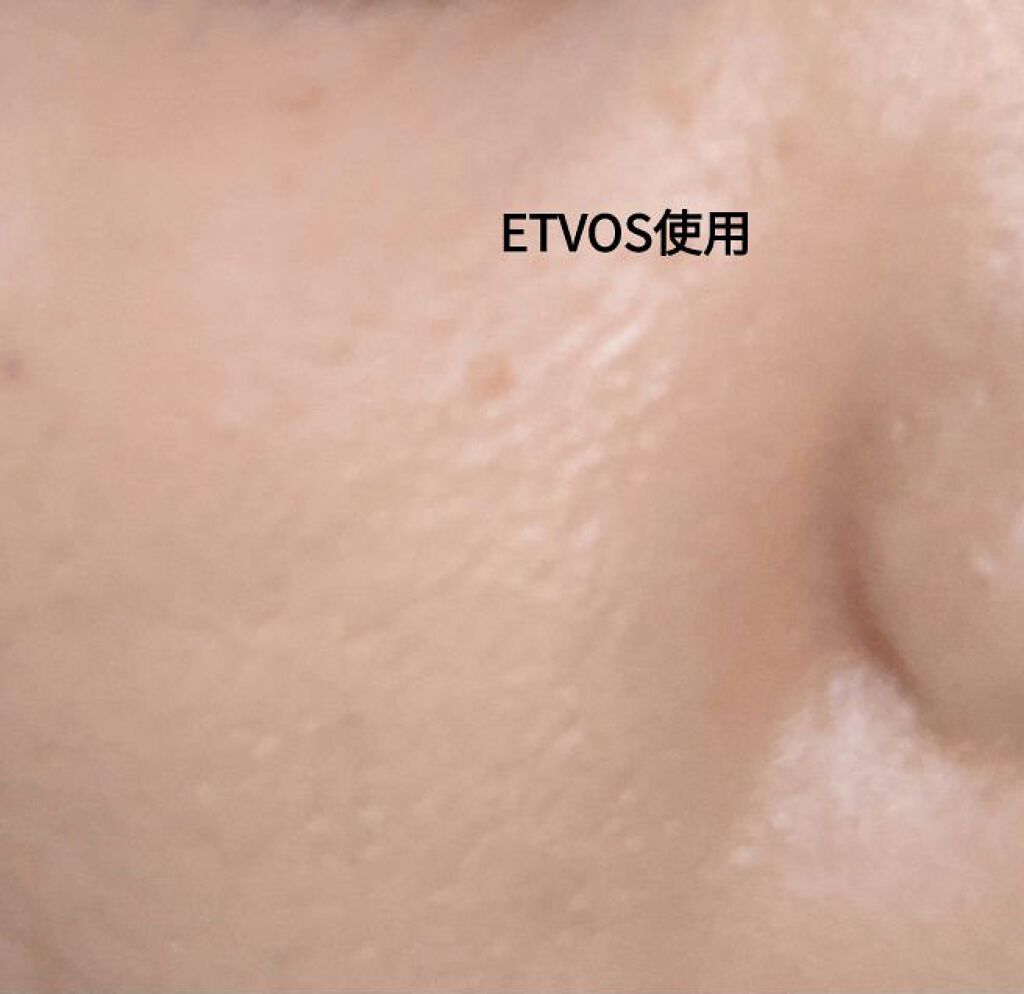 NスターターキットD(ツヤ)/エトヴォス/トライアルキットを使ったクチコミ（2枚目）