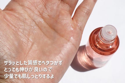 バイオイル/バイオイル/フェイスオイルを使ったクチコミ(2枚目)