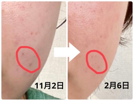 クリーム UFC/Kiehl's/フェイスクリームを使ったクチコミ(2枚目)