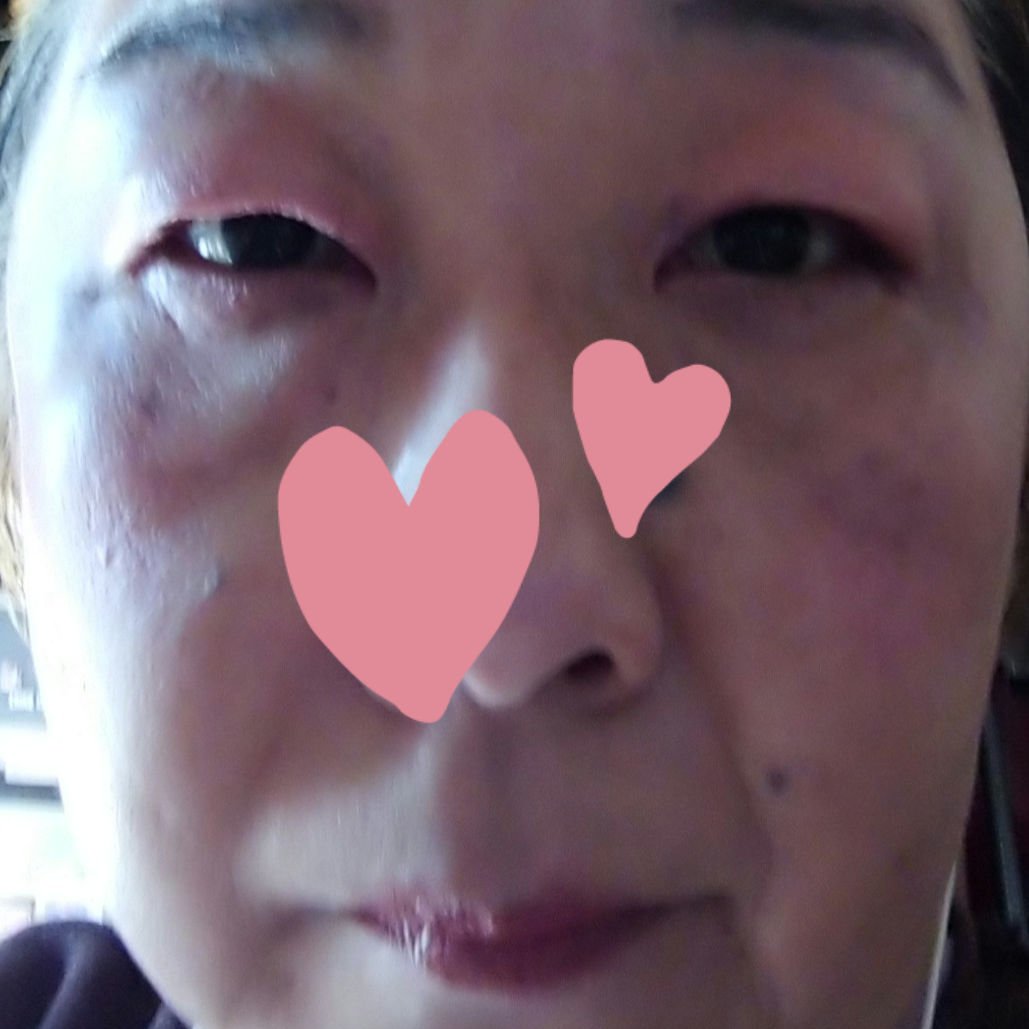 フィットミー リキッド ファンデーション DN/MAYBELLINE NEW YORK/リキッドファンデーションを使ったクチコミ（3枚目）