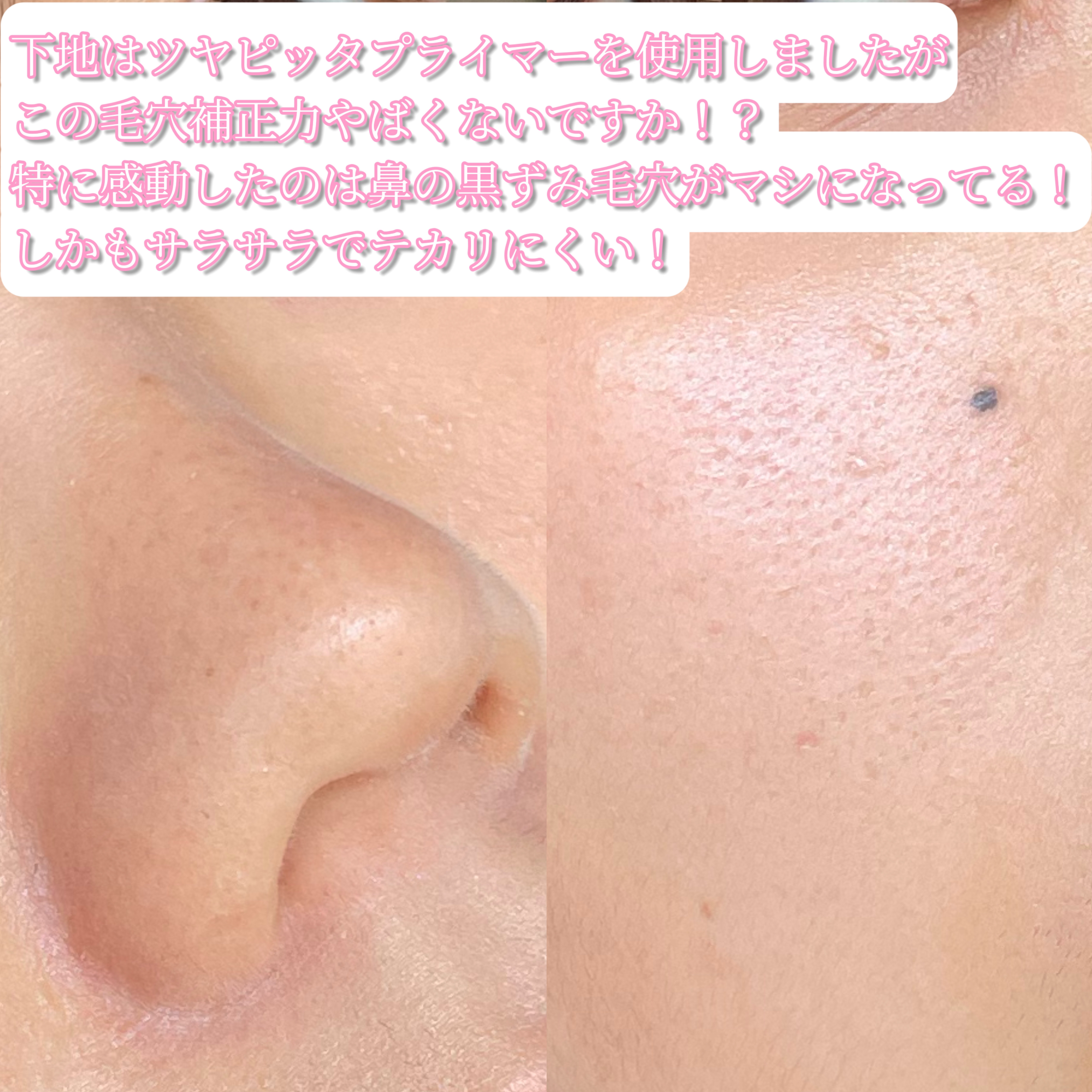 ヨレンパウダー ツヤカバー/muice/ルースパウダーを使ったクチコミ（2枚目）