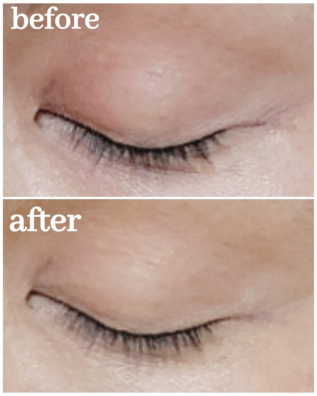 バナナ コンシールアイクリーム/shaishaishai/アイケア・アイクリームを使ったクチコミ(4枚目)