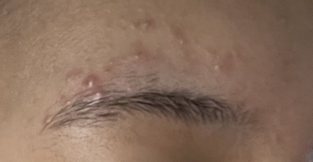 薬用しみ対策 美白化粧水/メラノCC/化粧水を使ったクチコミ（3枚目）