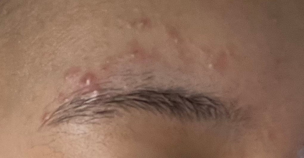 薬用 しみ 集中対策 美容液/メラノCC/美容液を使ったクチコミ(3枚目)