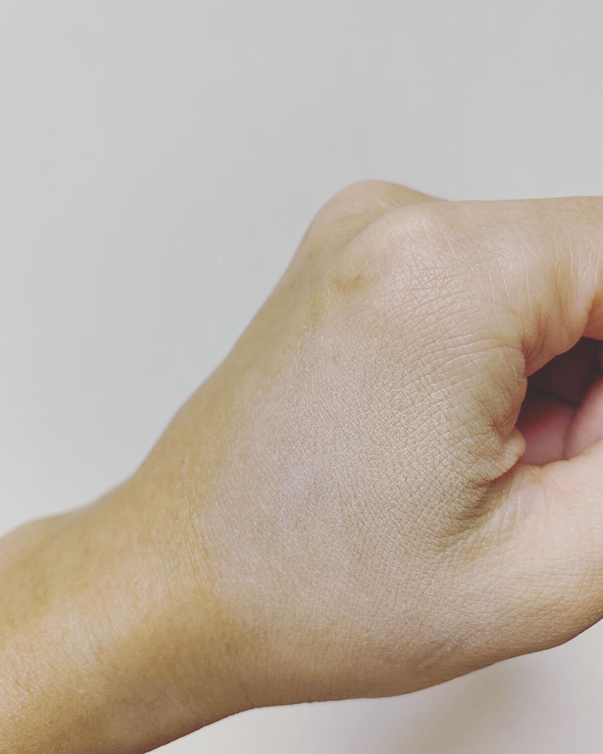 タトゥーウォータープルーフスカーコンシーラー/フォレンコス/リキッドコンシーラーを使ったクチコミ(8枚目)