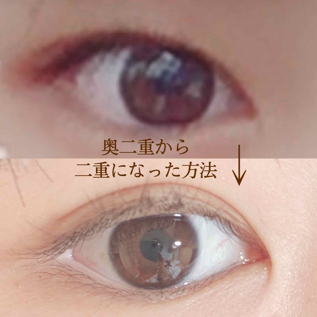 ナチュラルアイテープ/ビューティーワールド/二重まぶた用アイテムを使ったクチコミ（1枚目）