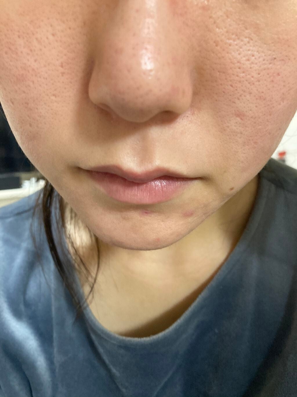 オバジC10セラム/オバジ/美容液を使ったクチコミ(2枚目)