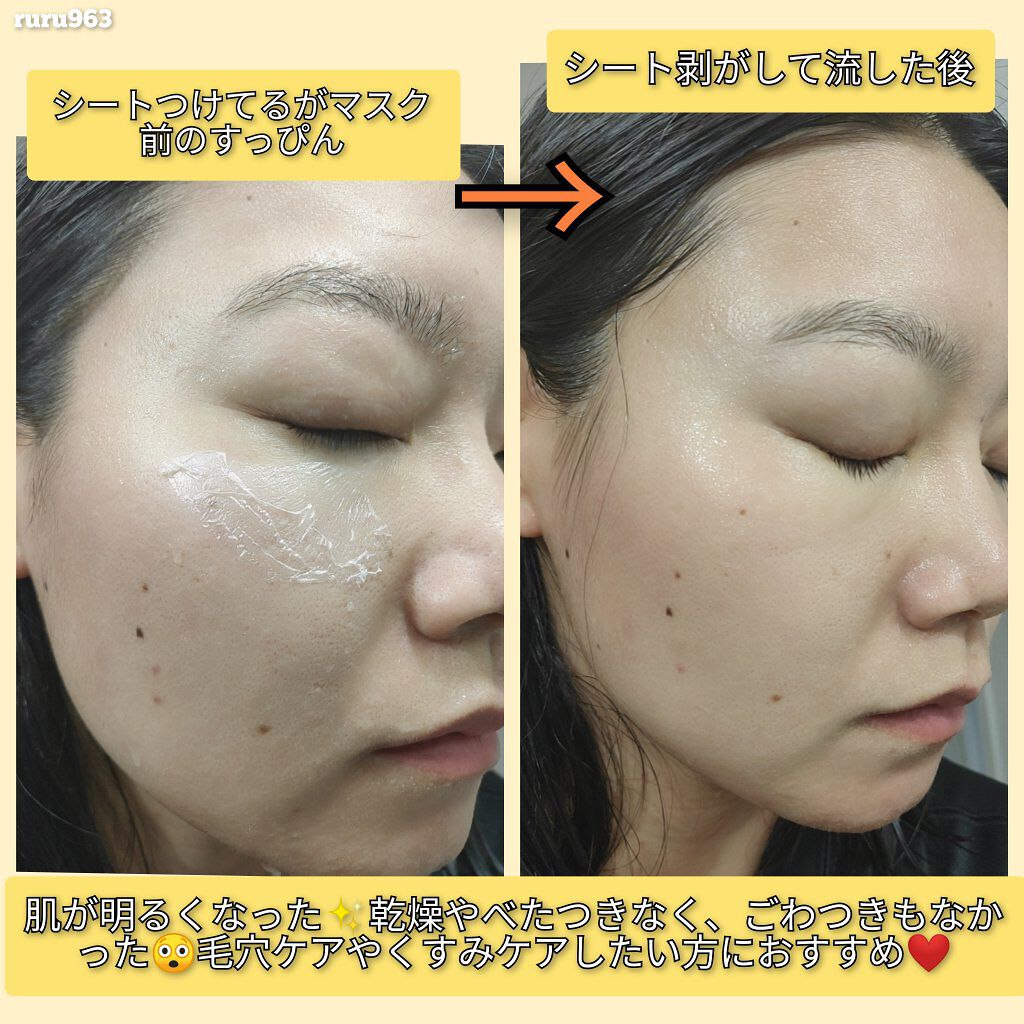 もこもこビタミンC泡マスク/リッツ/シートマスク・パックを使ったクチコミ(5枚目)