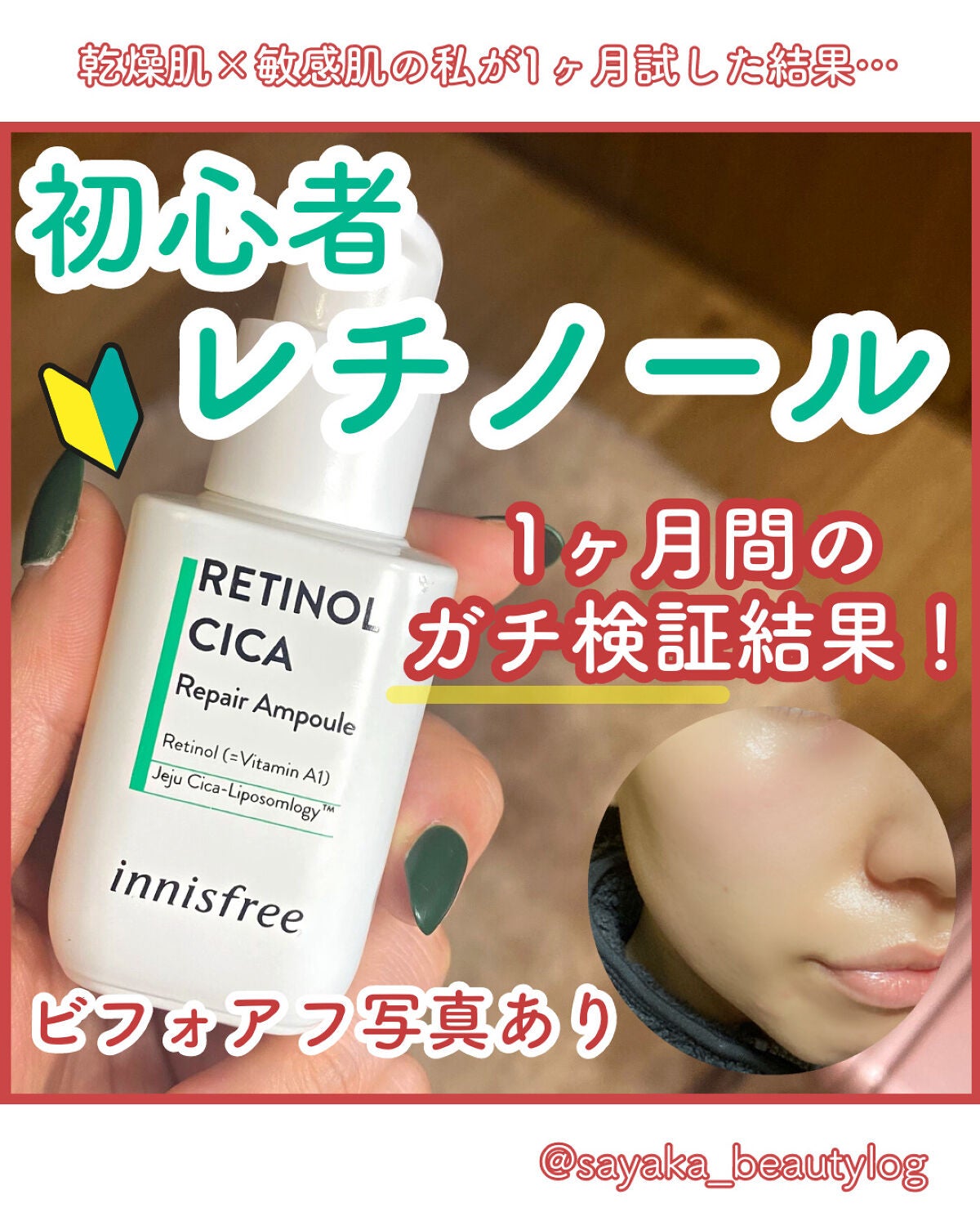レチノール シカ リペア セラム/innisfree/美容液を使ったクチコミ(1枚目)