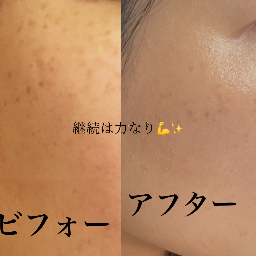 KISO・エリクシール・HAKUの美容液を使った口コミ -エリクシール