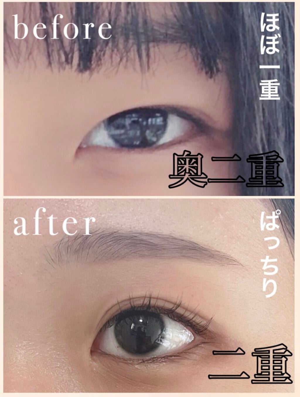 ワンダーアイリッドテープ Extra/D-UP/二重まぶた用アイテムを使ったクチコミ(1枚目)