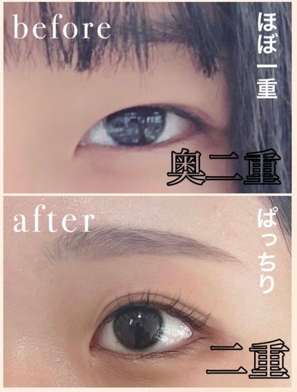 ワンダーアイリッドテープ Extra/D-UP/二重まぶた用アイテムを使ったクチコミ(1枚目)