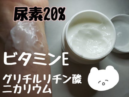 U20クリーム(医薬品)/メンターム/その他を使ったクチコミ(3枚目)