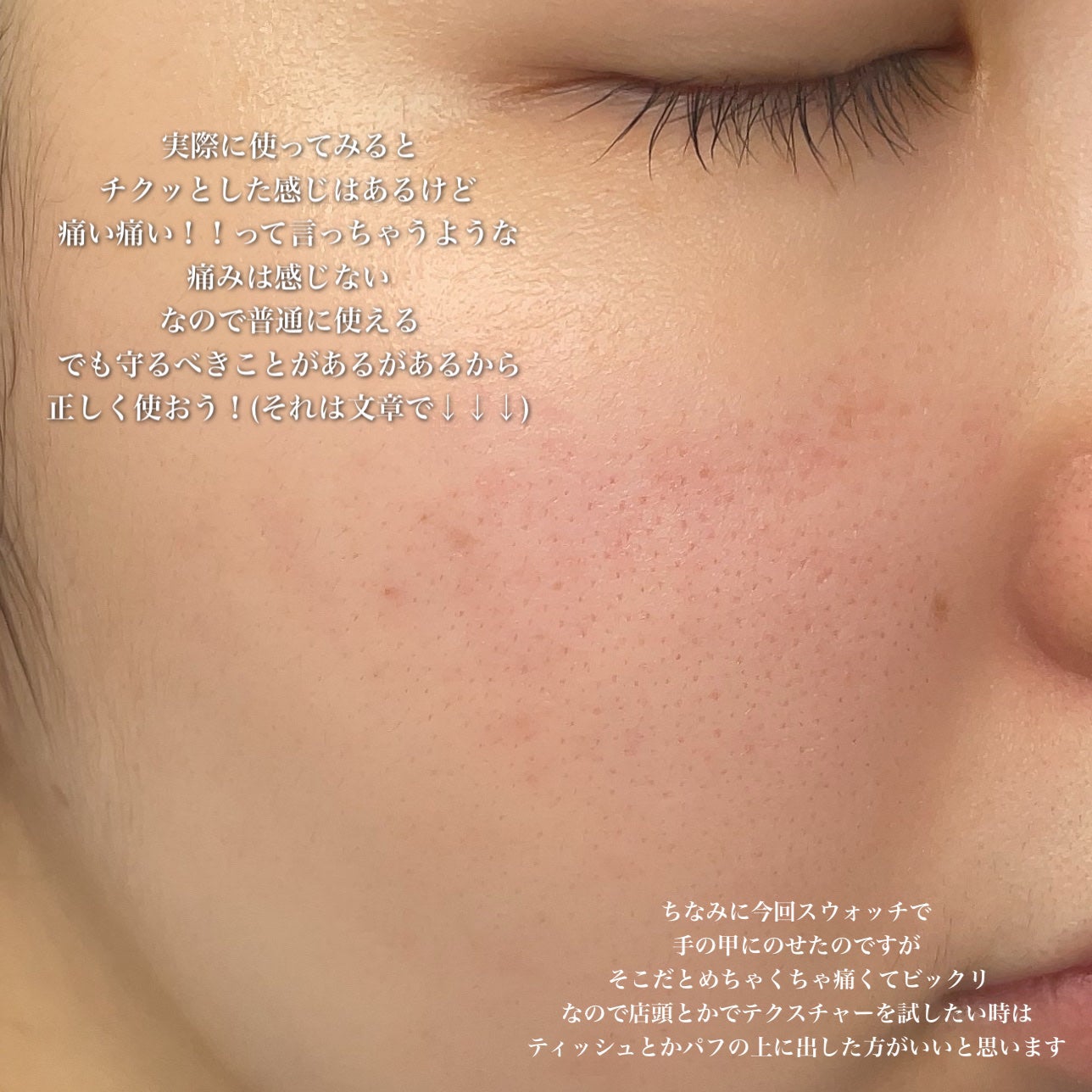 RTXセラム ビタミンショット/Dr.G/美容液を使ったクチコミ(7枚目)