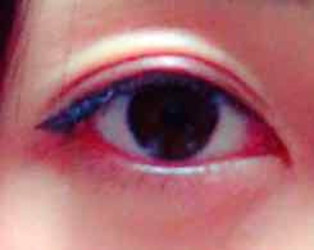 さいきc 治療クリーム（医薬品）/Saiki/その他を使ったクチコミ（1枚目）