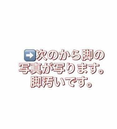 イチゴ🍓 on LIPS 「私が2週間で2㎝細くなった方法第2弾です！第1弾を見てない人は..」（2枚目）