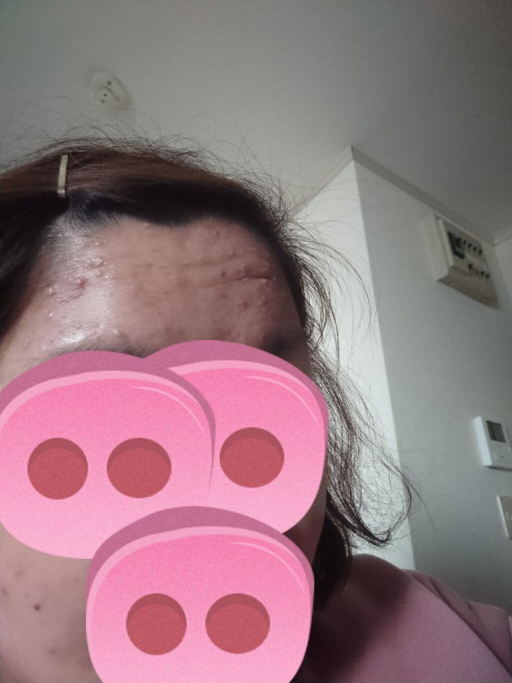 スチーマー ナノケア EH-SA3B/Panasonic/美顔器・マッサージを使ったクチコミ（2枚目）