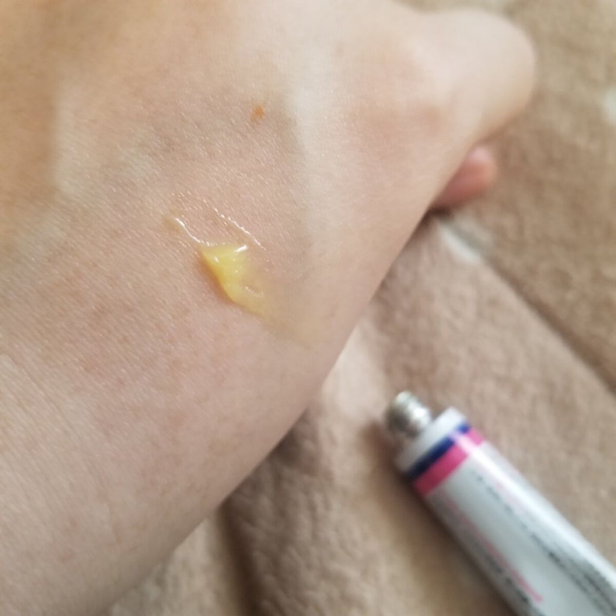 テラ・コートリル 軟膏(医薬品)/ジョンソン・エンド・ジョンソン/その他を使ったクチコミ(3枚目)