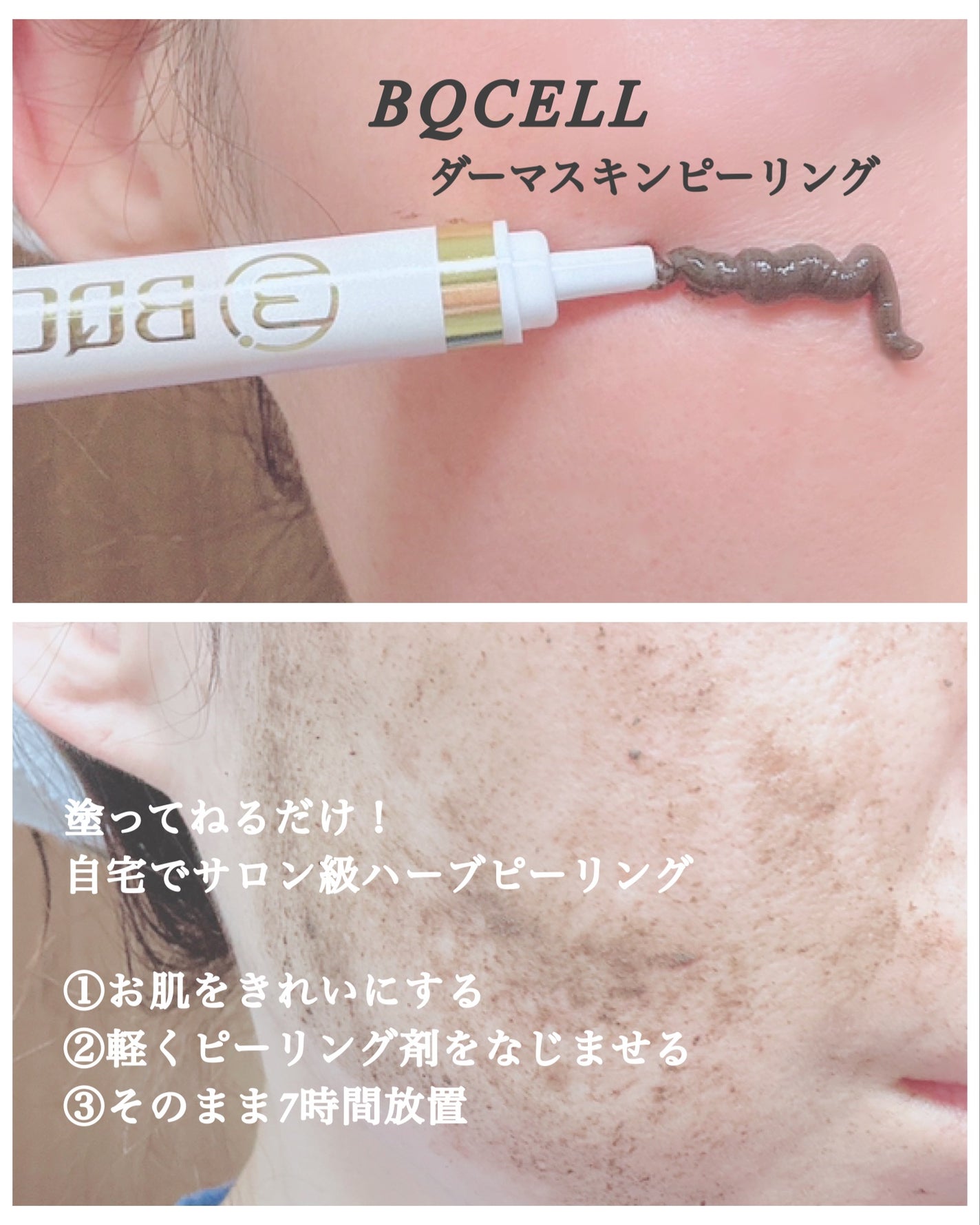 ダーマスキンピーリング/BQCELL/その他キットセットを使ったクチコミ(3枚目)