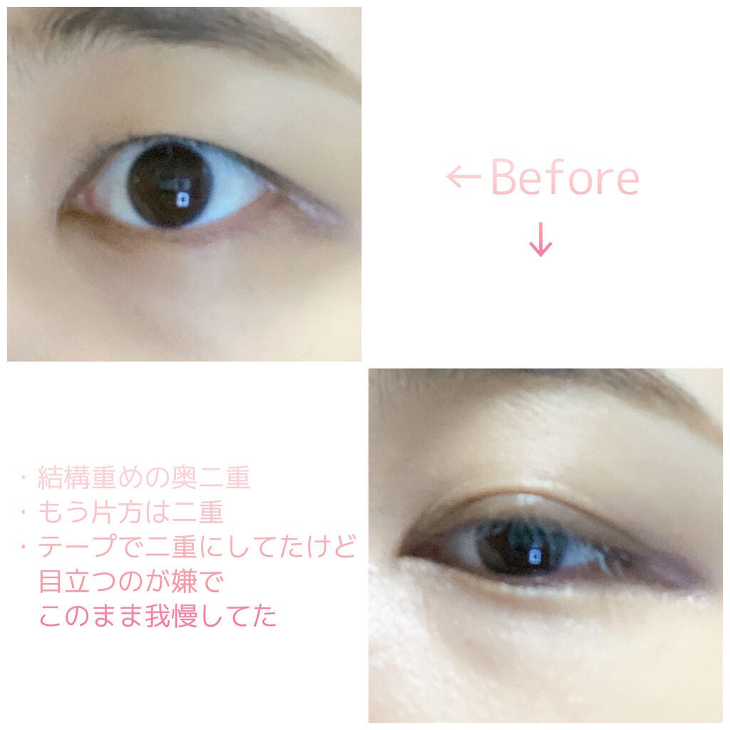 TWOOL ダブルアイリッドグルー/SHOBIDO/二重まぶた用アイテムを使ったクチコミ(2枚目)