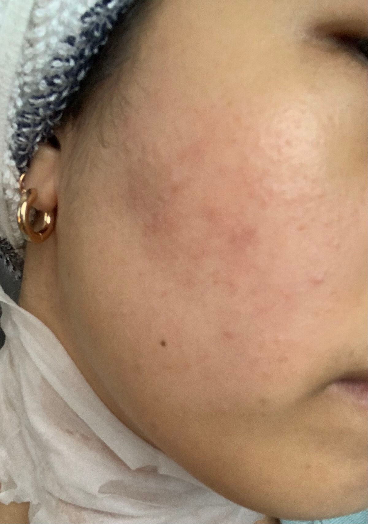 グリーンダーマCICA デイリーシートマスク/ネイチャーリパブリック/シートマスク・パックを使ったクチコミ(1枚目)