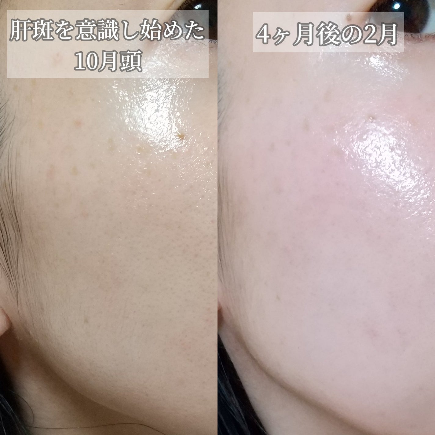 ハイドロクリームPHQ-5/KISO/フェイスクリームを使ったクチコミ(7枚目)