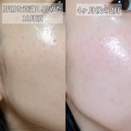 ハイドロクリームPHQ-5/KISO/フェイスクリームを使ったクチコミ(7枚目)