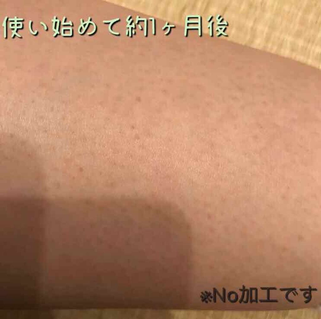 ケアノキュア(医薬品)/小林製薬/その他を使ったクチコミ(2枚目)