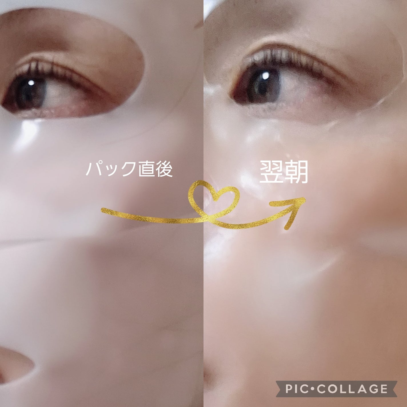 フェイシャル保湿パック/Dermall matrix/シートマスク・パックを使ったクチコミ(4枚目)