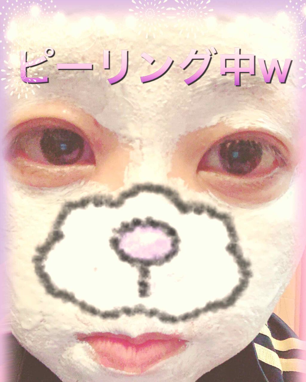 目ざまシート 完熟果実の高保湿タイプ/サボリーノ/シートマスク・パックを使ったクチコミ(2枚目)