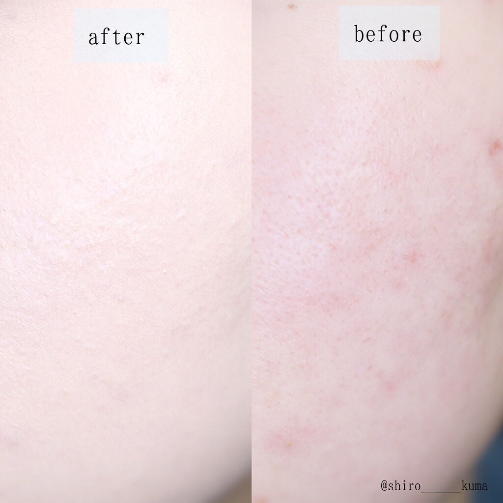 ピンクティーツリーカバークッション/APLIN/クッションファンデーションを使ったクチコミ(7枚目)