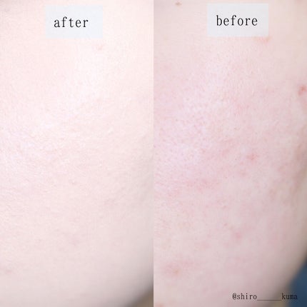 ピンクティーツリーカバークッション/APLIN/クッションファンデーションを使ったクチコミ(7枚目)