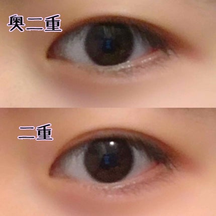 肌色タイプ/バンドエイド/その他を使ったクチコミ(2枚目)