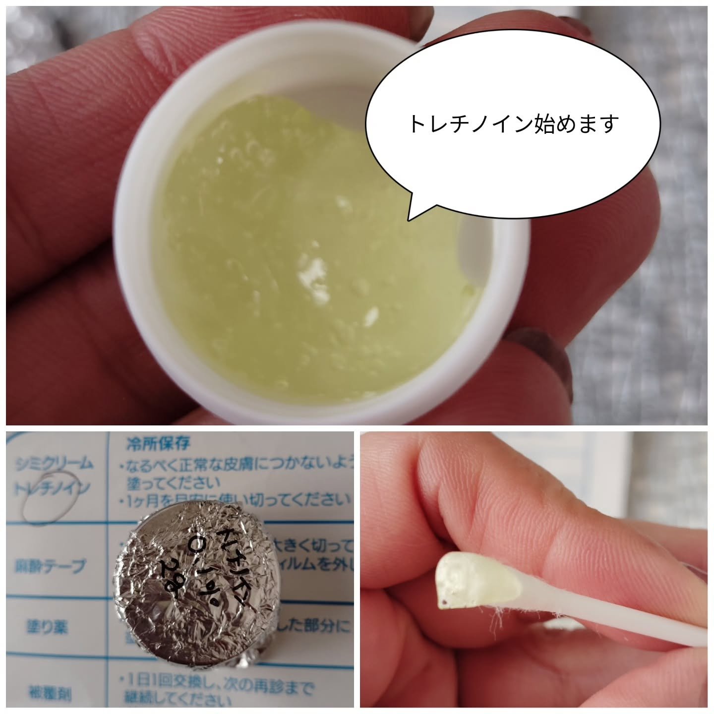 トラネキサム酸　250mg/東和薬品/その他を使ったクチコミ（1枚目）