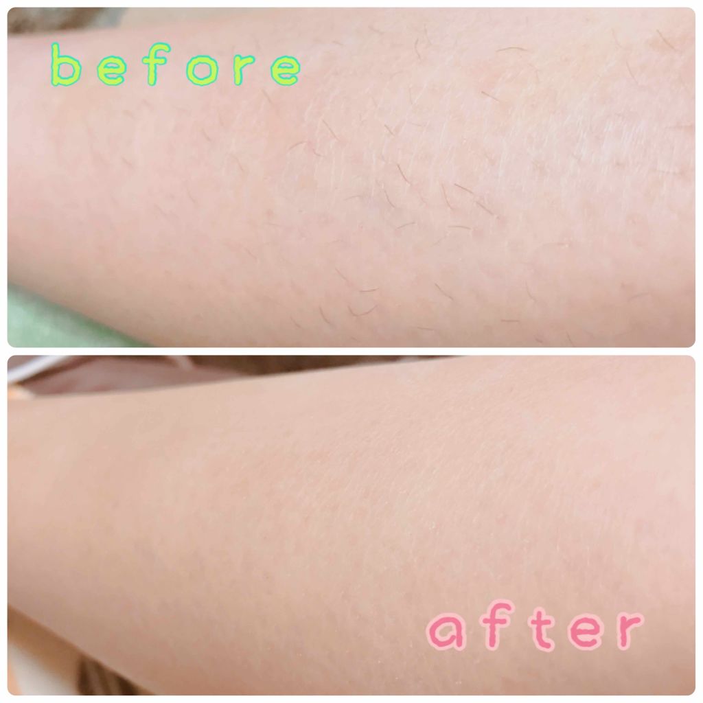 スムーズスキン/DAISO/ムダ毛ケアを使ったクチコミ(2枚目)