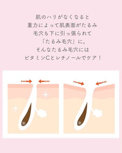 アヌア ビタミンC20 ブレミッシュセラム/Anua/美容液を使ったクチコミ(2枚目)