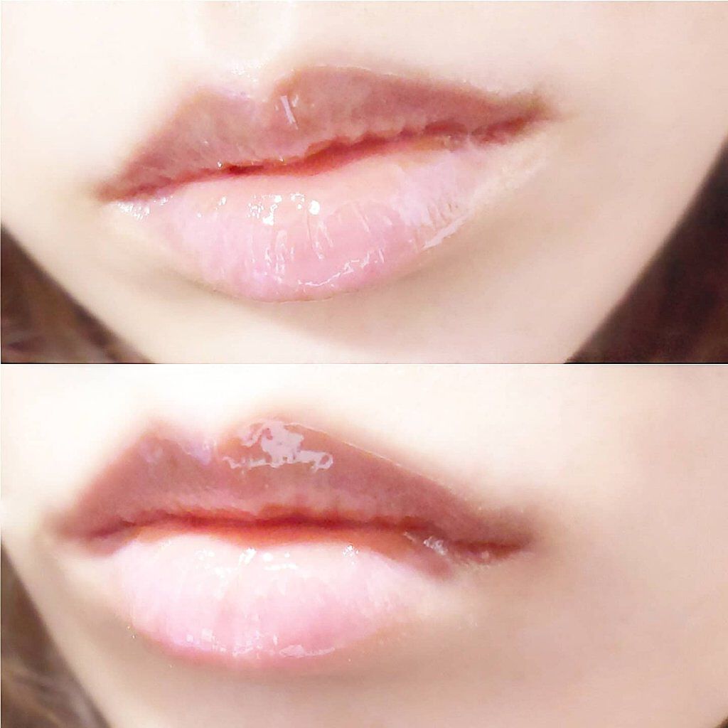 リップケア バーム/キュレル/リップバームを使ったクチコミ（2枚目）