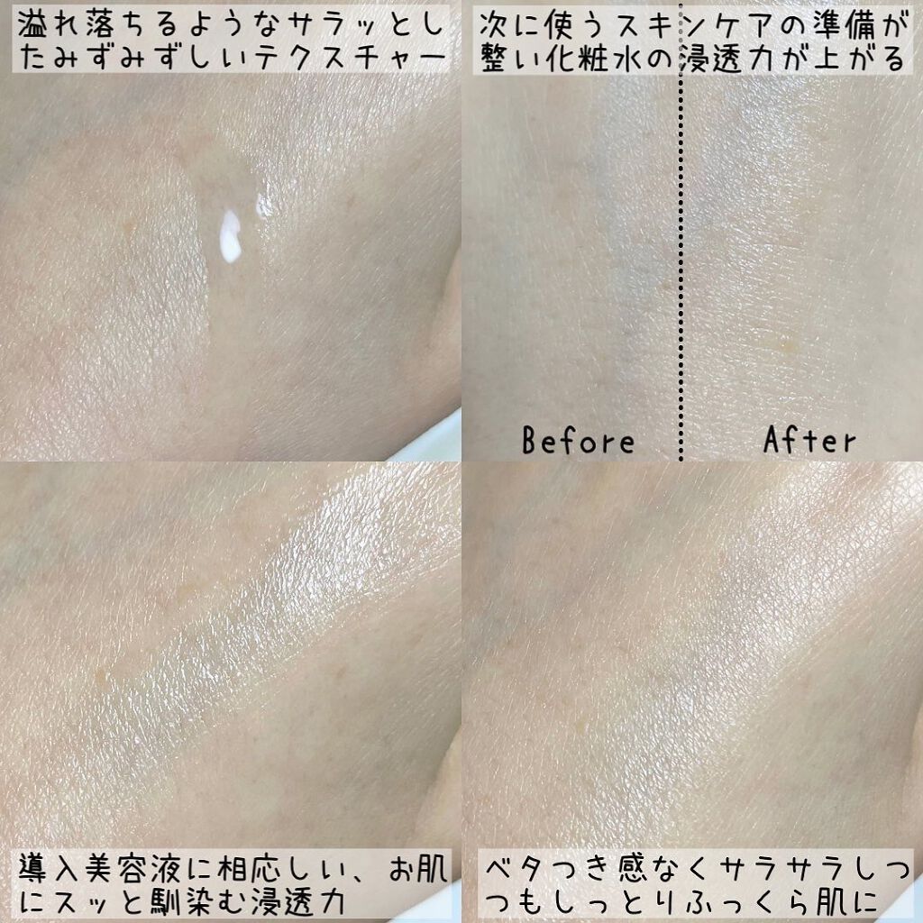 透輝の滴/アクアヴィーナス/美容液を使ったクチコミ(4枚目)