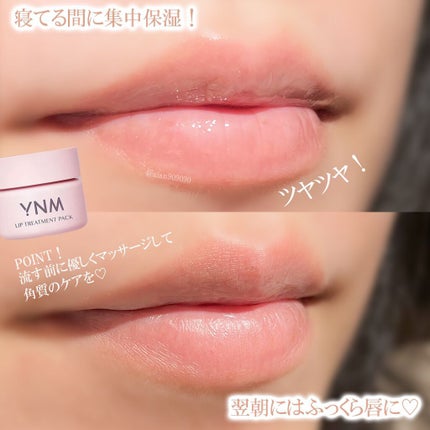 YNM リップトリートメントパック/YNM/リップマスクを使ったクチコミ(5枚目)